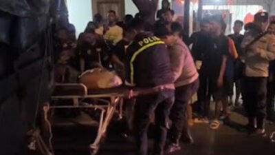 Tabrak Mobil, Kaki Pemotor Terlindas Truk